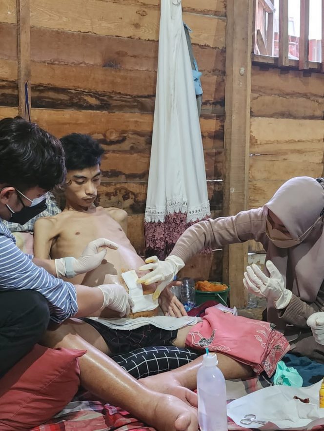 
 Ibnu Umair Ibrahim, anak penderita Tumor Abdomen di Kelurahan Donggala Kodi/Ist